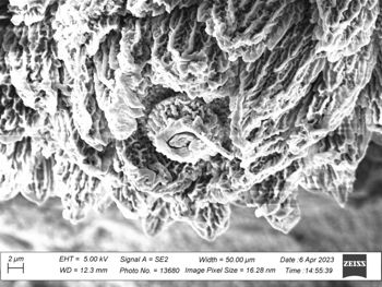 Media type: image;   Invertebrate Zoology 32029 Description: SEM image of specimen.;  Aspect: dorsal